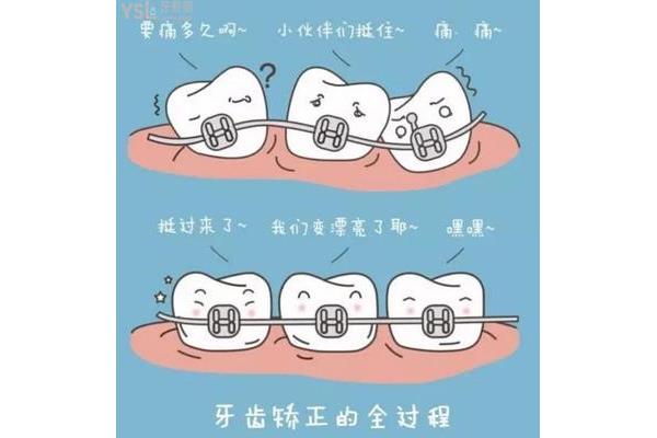 牙齒多久能開門