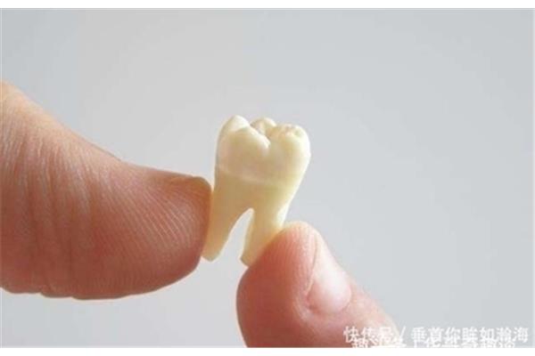小孩子換牙多久才能長出新牙