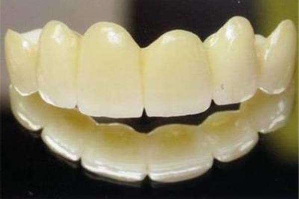 二氧化鋯全瓷牙能用多久