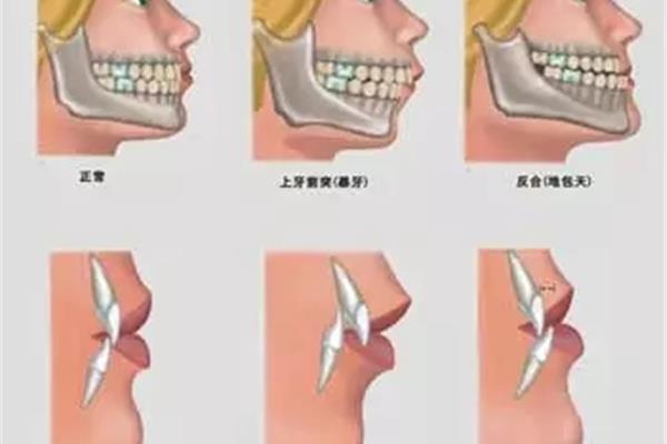 正常人牙齒能用多久