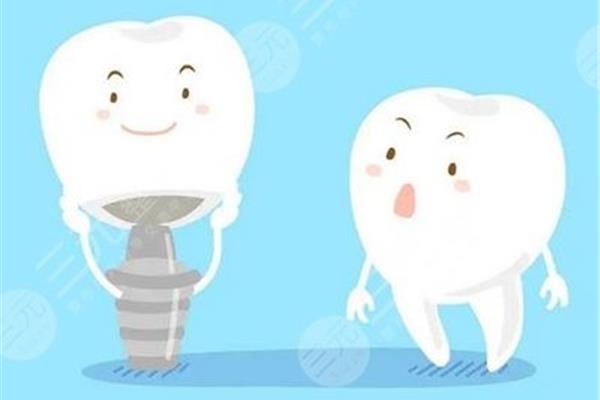 種牙術后多久可以吃東西? 種植牙手術后多久可以吃東西?