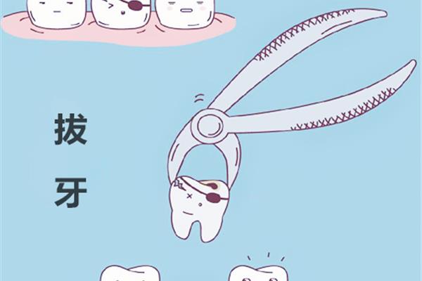 拔牙側多久可以刷牙