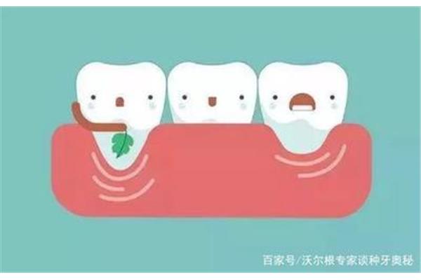 牙齒多久才不會松動