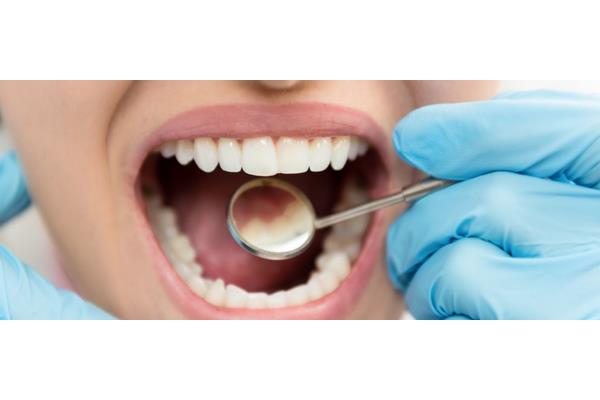 牙齒補洞能用多久