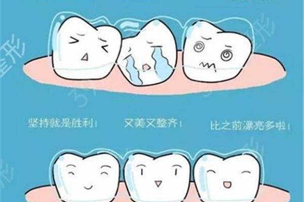 拔牙換牙齒多久
