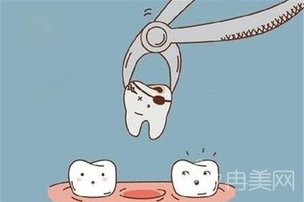 拔牙齒需要多久恢復?一般需要三天