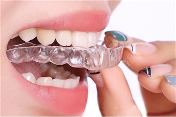 牙齒保持器能用多久