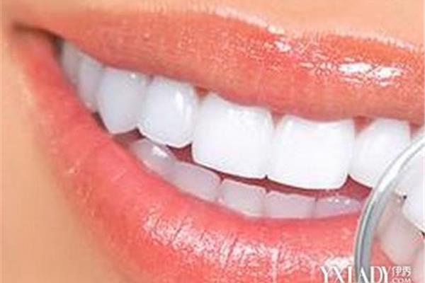 花生可以美白牙齒嗎?花生保持牙齒美白方法很簡單