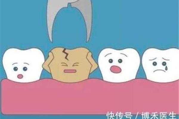 流產后多久可以拔牙?可以在小月子期間拔牙嗎?