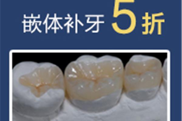 嵌體補牙能用多久