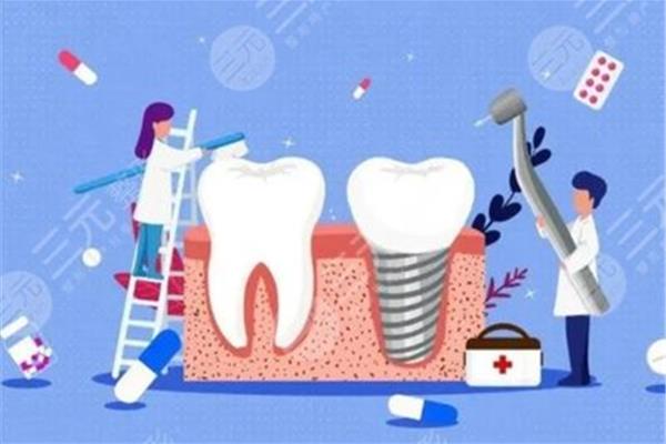 牙齒正畸需要多長時間才能完成?