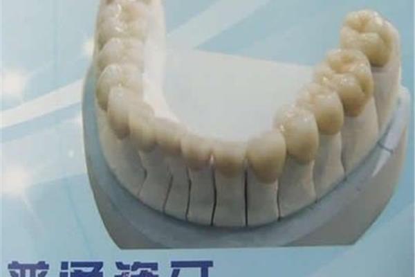 一顆陶瓷牙能用多久