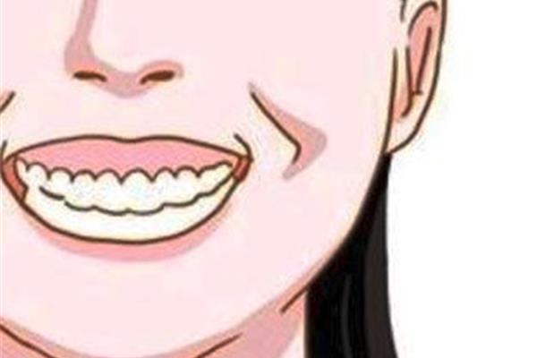 為什么牙齒正畸要用骨釘? 戴牙套多久能打骨釘?