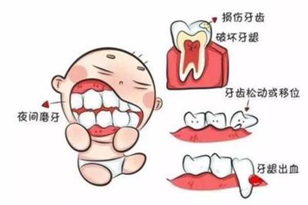 磨牙后多長時間門牙不酸,過橋磨牙后多長時間門牙會酸?