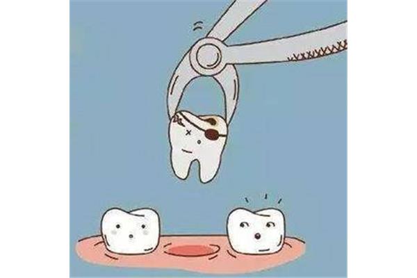 拔牙后多久可做牙齒矯正? 牙齒矯正拔牙疼多久