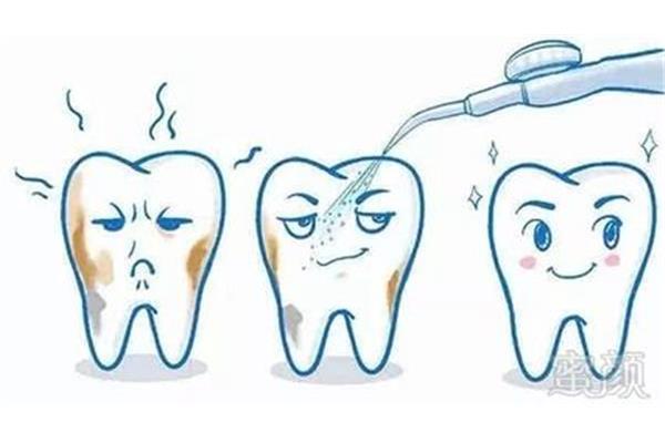 怎么洗牙才能正常吃東西? 潔牙后多久能刷牙