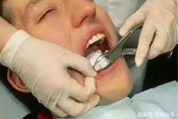 拔門牙后多久能種牙