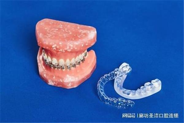 牙齒矯正保持器要佩戴多久?