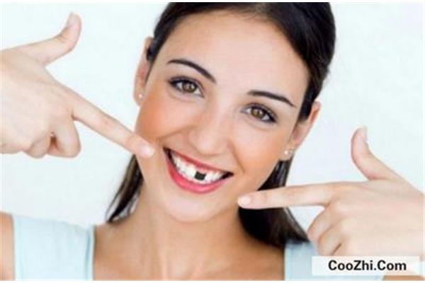 臨時門牙可以做多久?臨時牙最多能戴多久?