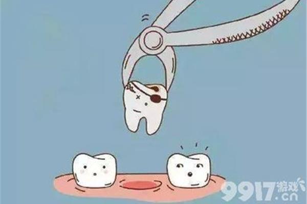 拔牙手術得多久