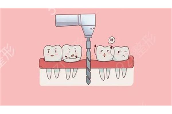 牙齒多久能恢復