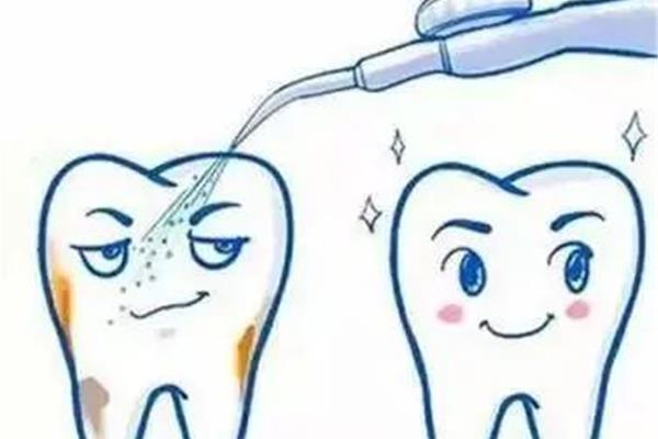 兒童洗牙要多久