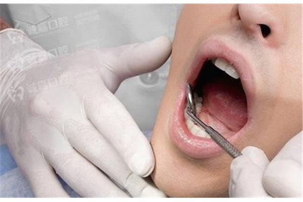 外傷牙齒松動需要多長時間恢復,外傷牙齒骨折如何治療?