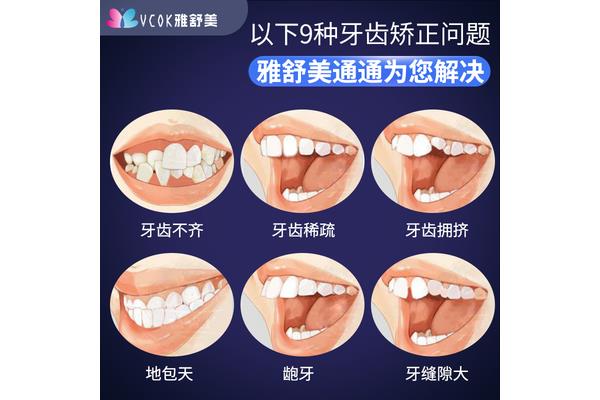 牙齒隱形固位體矯正需要多久,隱形牙套矯正需要多久?