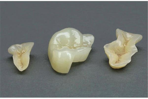 兒童補牙多久會脫落,牙齒表面補牙多久會脫落?