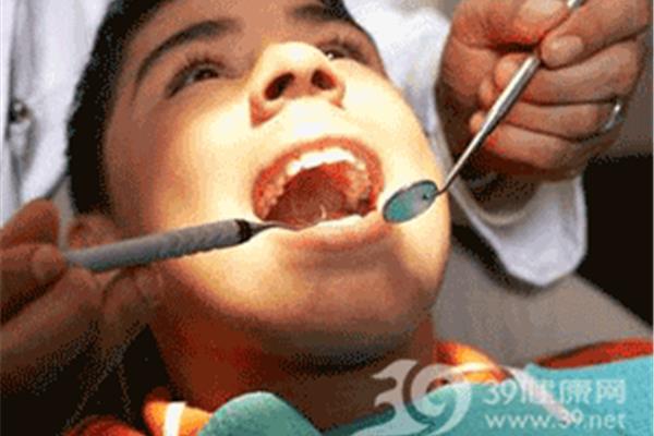 牙科治療補牙需要多長時間?牙科治療多久可以補牙?