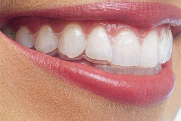 外傷牙齒多久能恢復