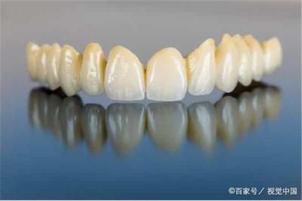 全景牙片可以用a4紙打印嗎?德國數碼牙片機的使用壽命
