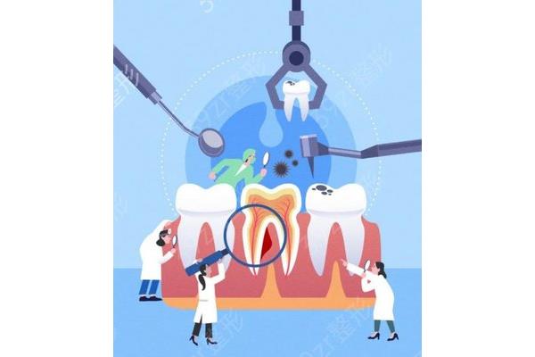 喉鏡后多久可以吃東西,牙齒后多久可以吃東西?