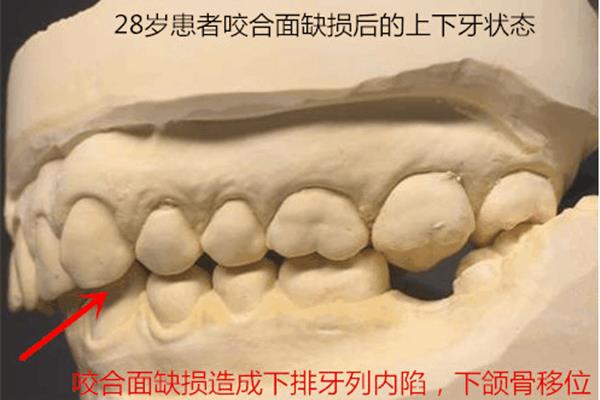 地墊需要多長時間恢復,牙齒需要多長時間抖動?