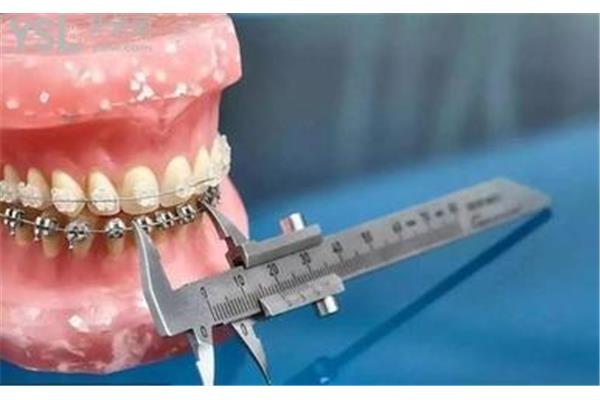 鑲嵌的鋼牙還能撐多久,之前鑲嵌的鋼牙還能撐多久?