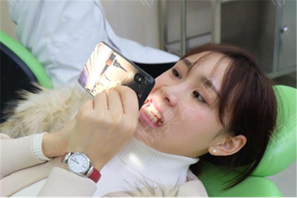 醫院做牙套要多久,隱形牙套需要多久去一次醫院?