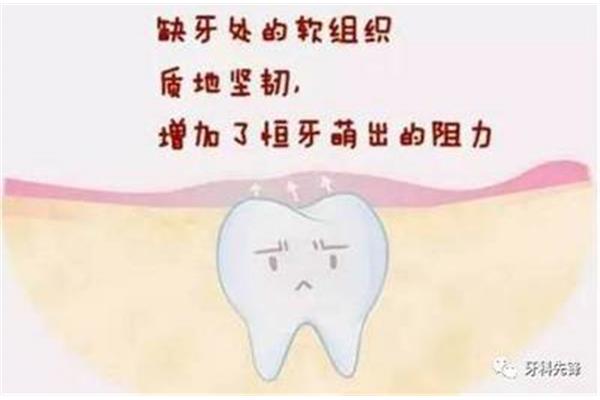 牙齒變壞和長牙要多久才能出來?
