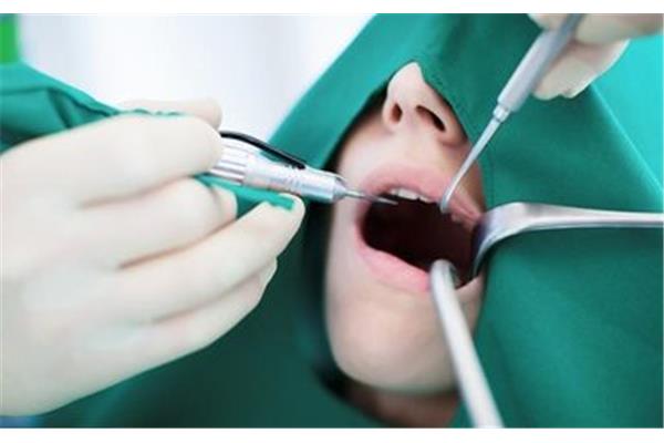 種植牙手術,做種植牙的過程需要多長時間?