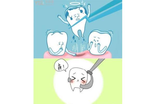 拔牙過多久可以補鄰牙