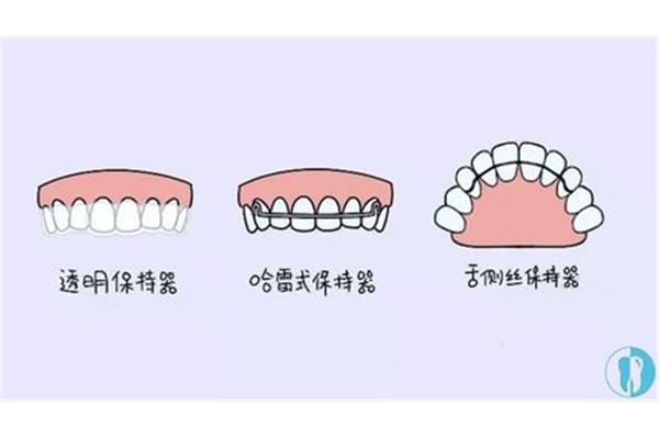 固位體牙套每天佩戴時間,固位體牙套佩戴時間