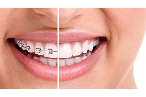 長一顆完整的牙齒需要多長時間?30歲整顆牙需要多久?