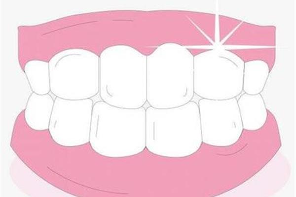 鑲牙一般多久能習慣