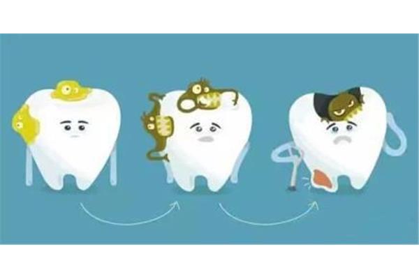 孩子乳牙補一顆牙要多少錢?孩子的乳牙補完一個洞能堅持多久?