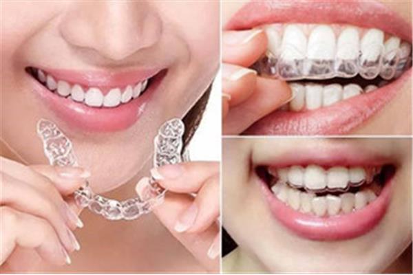 牙科做牙齒美白,牙齒美白醫院多少錢?