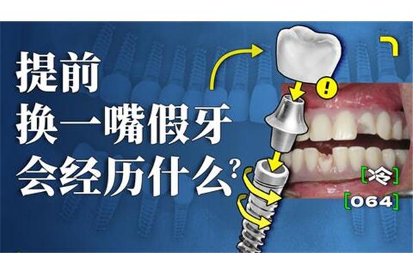 拔牙后多久可以種牙,拔牙后一般疼痛多久可以恢復?