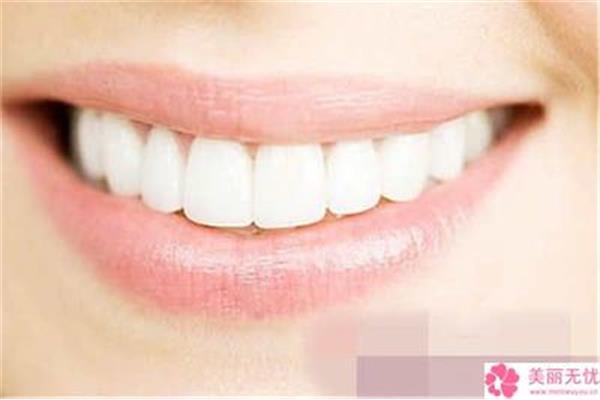 整牙裝牙套要多少錢?牙套會導致牙齒過早脫落嗎?