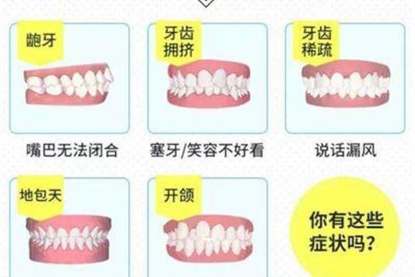 牙齒咬合需要多長時間矯正,正畸咬合需要多長時間調整?