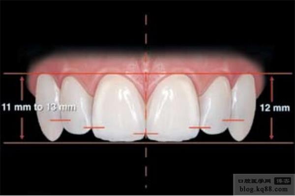 牙穿透樹脂能堅持多久?樹脂填充搪瓷