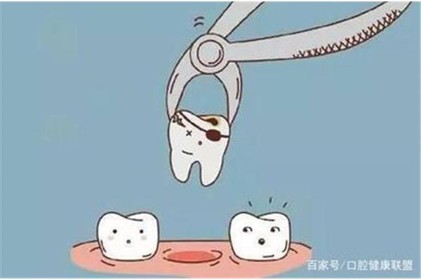 牙痛停止多久可以拔牙