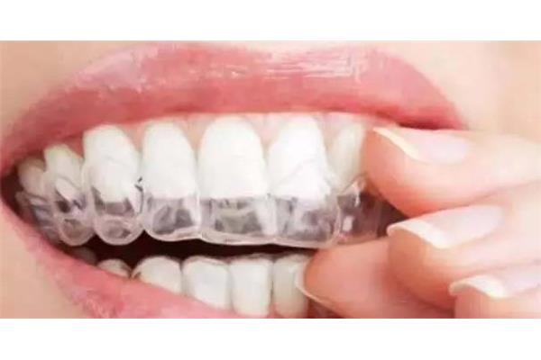 保持牙套矯正牙齒需要多長時間?